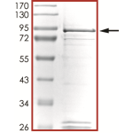EGFR (d746-750 L718Q T790M), Active